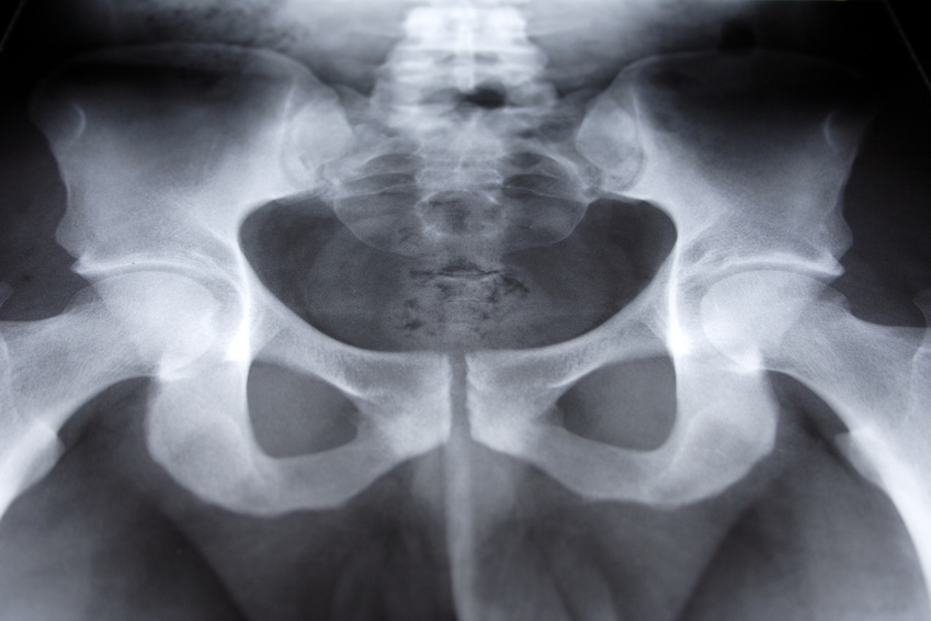 sanitas wallpaper. Sanitas Real Madrid - Desgarro