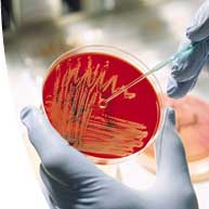 Ultimo artículo publicado acerca de  Sobre la Gripe A (H1N1)