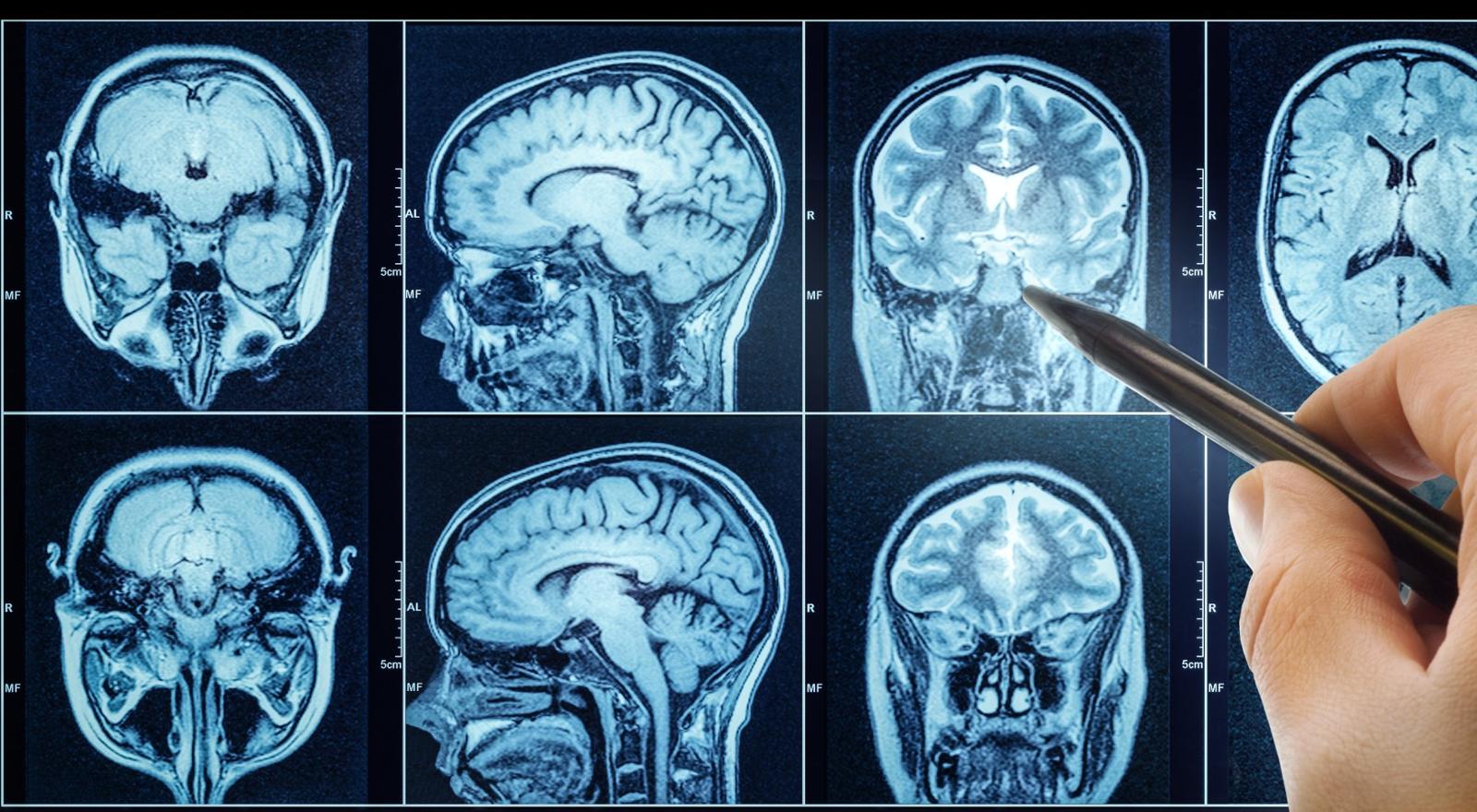 Centro Médico Sanitas Resonancia Magnética