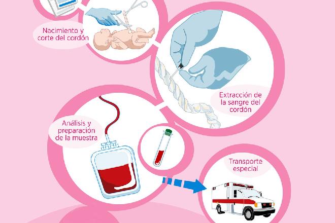 sanitas cordon umbilical