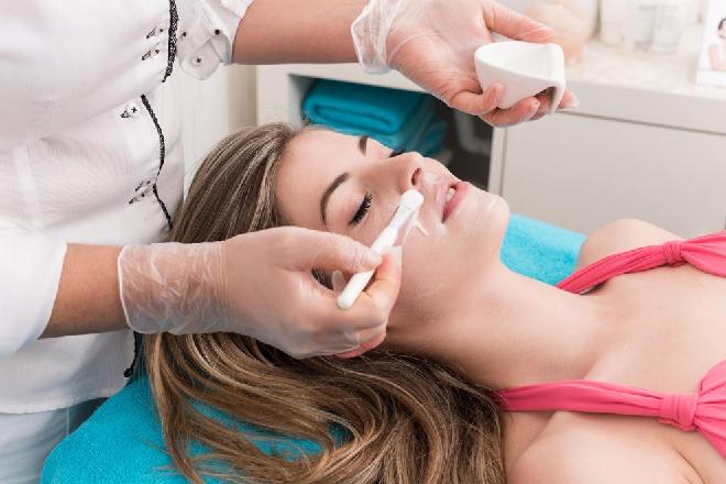 Peeling facial químico