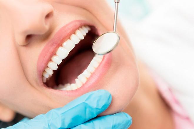 caries y empastes