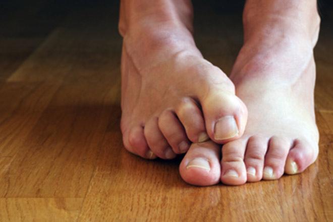 Información sobre lesiones musculares nerviosas óseas