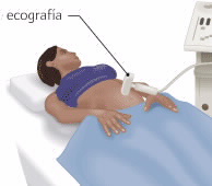 ecografia ginecologica