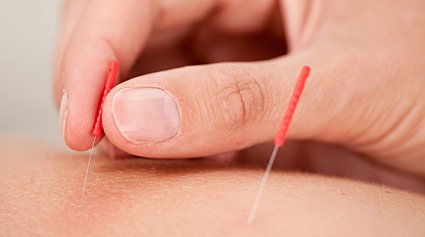 acupuntura para dejar de fumar