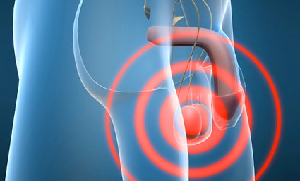 cáncer testicular preservar la fertilidad