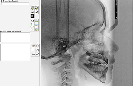 cefalometría odontología ortodoncia