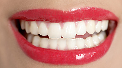materiales estética dental