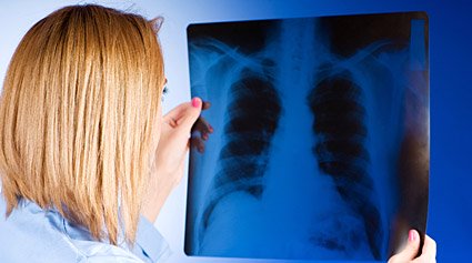 metástasis pulmonar