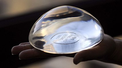 implantes mamarios riesgos