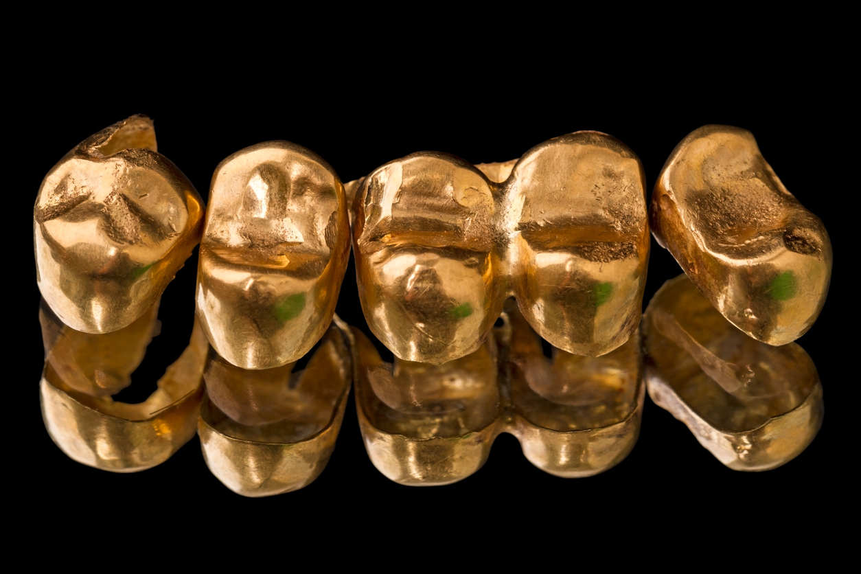 dientes de oro, diente de oro