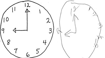 test del reloj