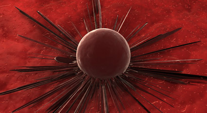 Imágen sobre metastasis