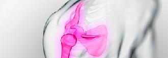 dolor neuromuscular