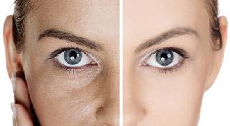 Peeling facial