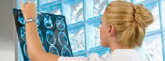 ictus accidentes cerebrovasculares