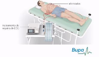 Foto: Representación de la prueba de electrocardiograma
