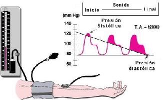 Imagen cardio hipertension