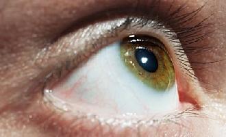 preguntas sobre el desprendimiento de retina