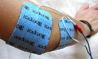 electroestimulación transcutánea