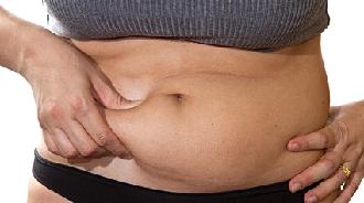 liposucción abdominal