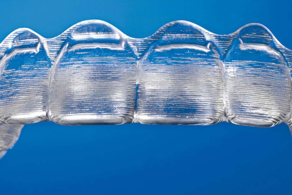 Invisalign ortodoncia invisible