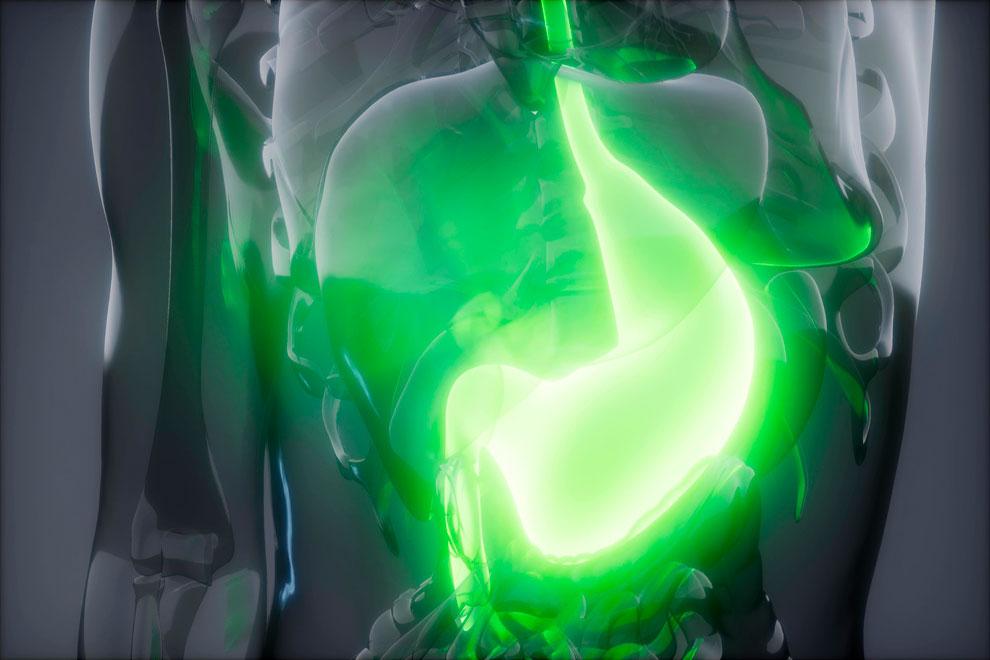 cáncer de estómago