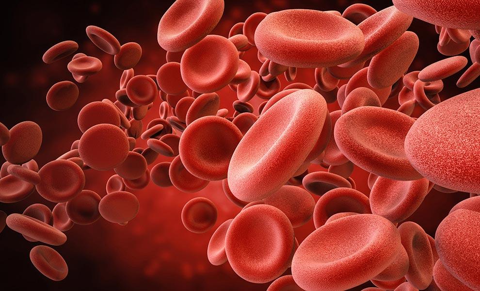 Anemia ferropénica