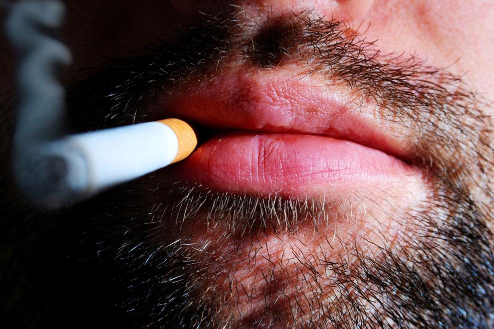 cáncer oral