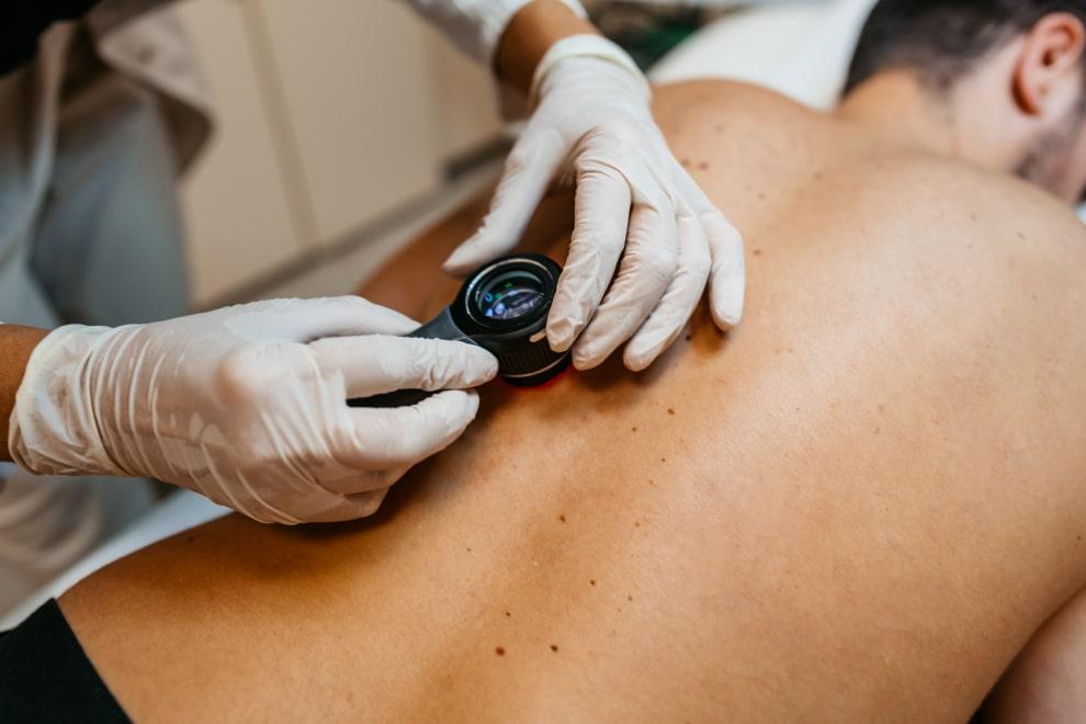 Cuándo ir al dermatólogo