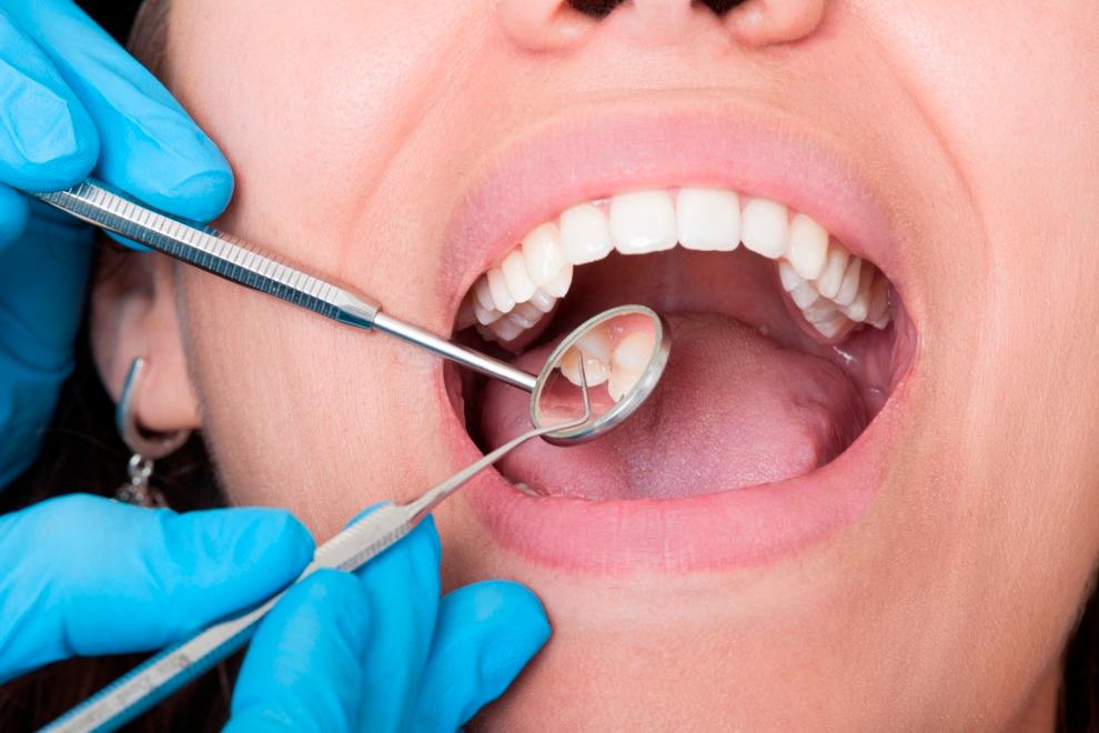 sindrome de la boca ardiente tratamiento, síndrome de la boca ardiente tratamiento