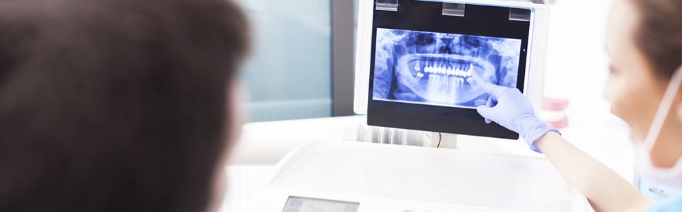 Tipos de caries