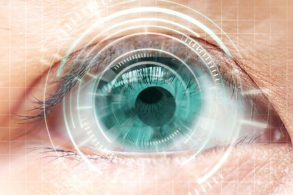 cirugía láser ocular