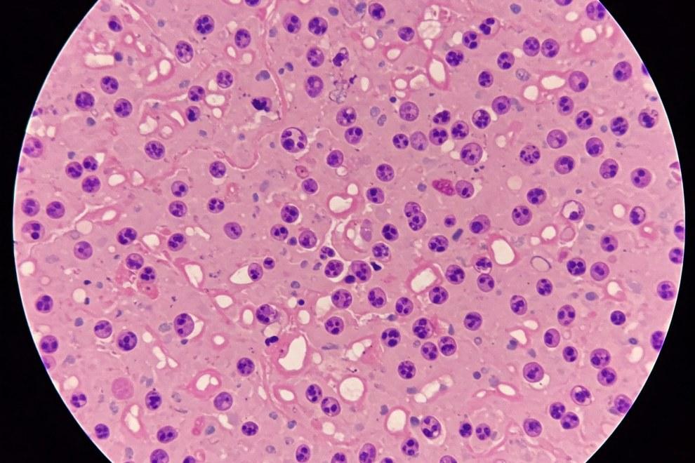 ¿La citología duele?