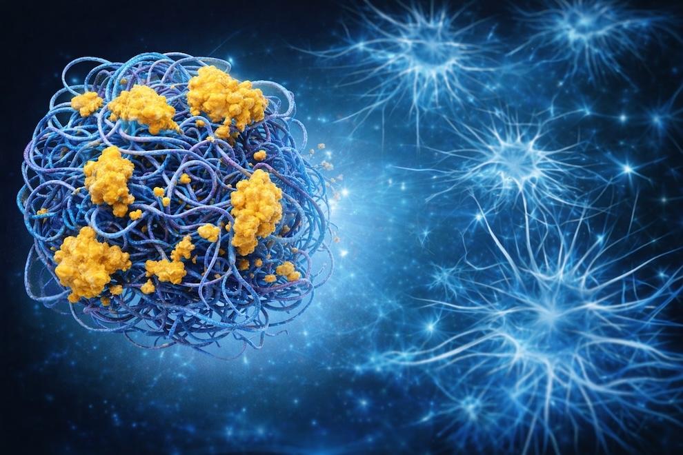 Qué es la Proteína Tau