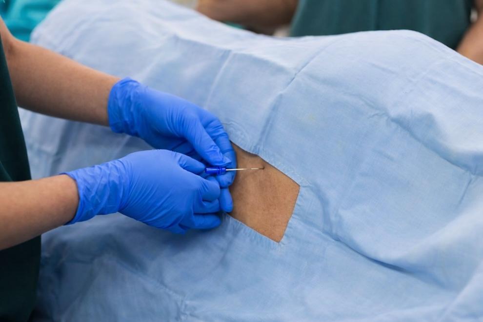 Qué es la punción lumbar