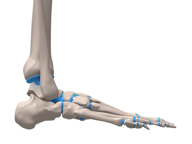 Imagen lesiones lesOsea frac lux tarso metatars dedos