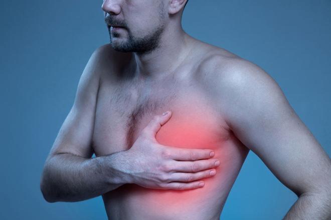 Cardiopatía isquémica