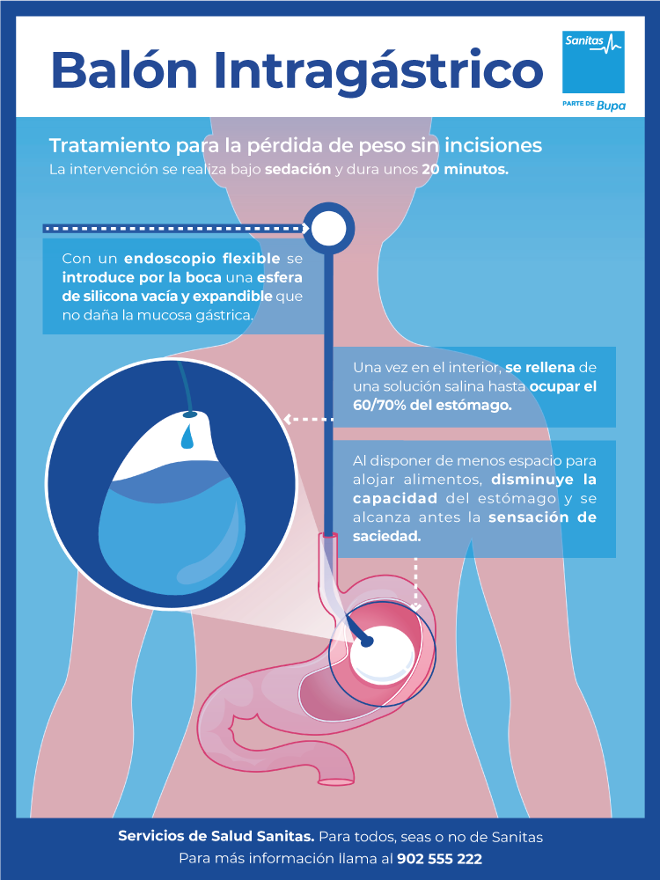 balón intragástrico