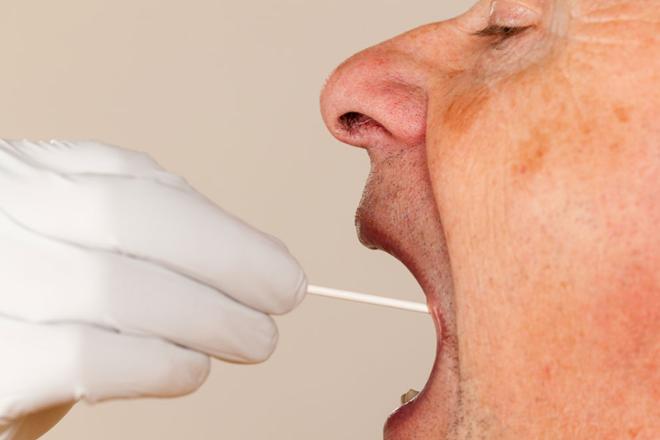 candidiasis oral en adultos