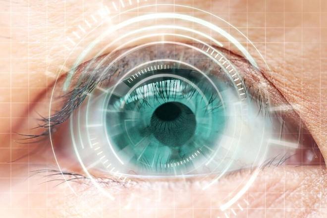 cirugía cataratas láser