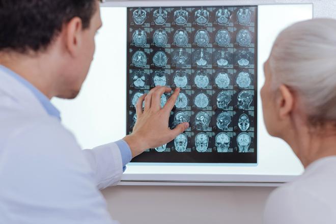 ¿Conoces bien el ictus?