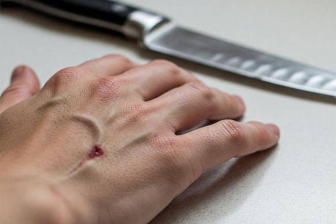 corte cuchillo accidente doméstico