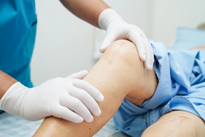 prótesis de rodilla