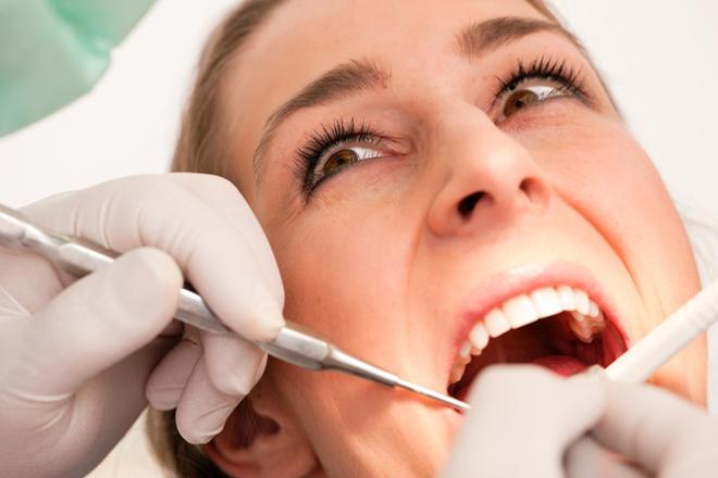 estomatitis traumatica, estomatitis traumática