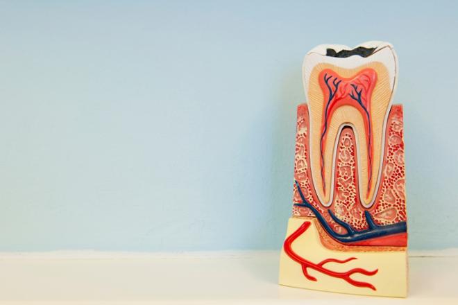 Disección vertical de una muela