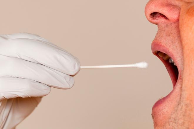 sindrome de la boca ardiente, síndrome de la boca ardiente