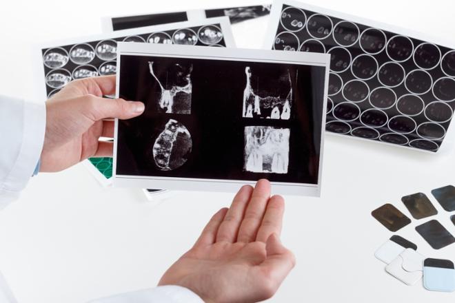 TAC dental, dental tac