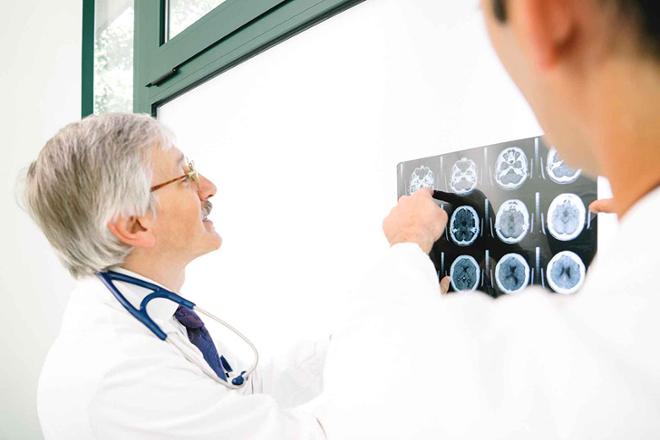 TCE en personas mayores