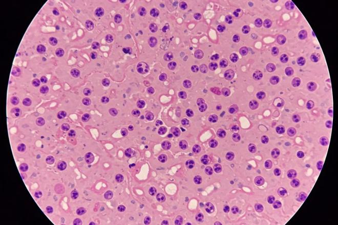 ¿La citología duele?